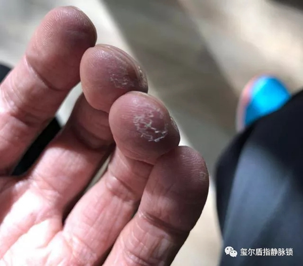 璽爾盾指靜脈鎖告訴您給老年人購買智能鎖需要注意什么